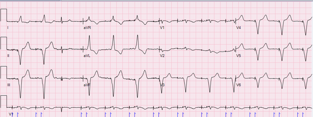 The World Of Ecgs: Level 3 Test – Cardiogauge