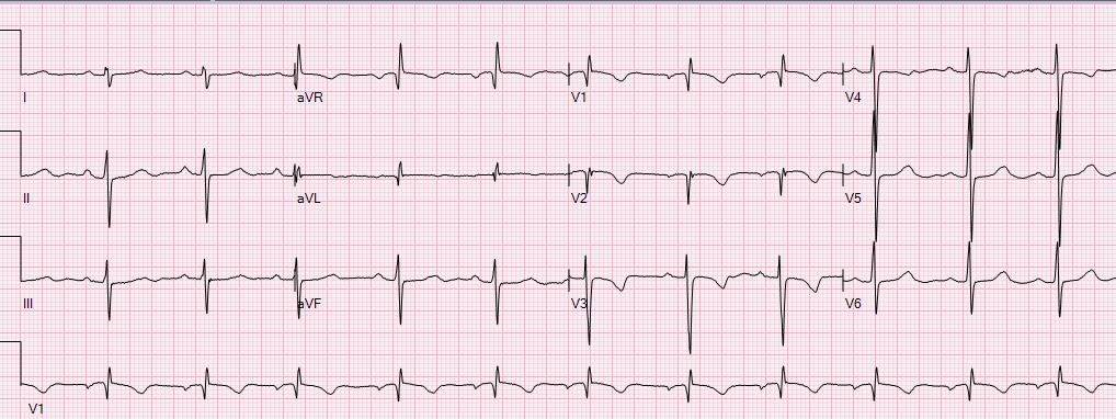 The World of ECGs: Level 3 Test – CardioGauge